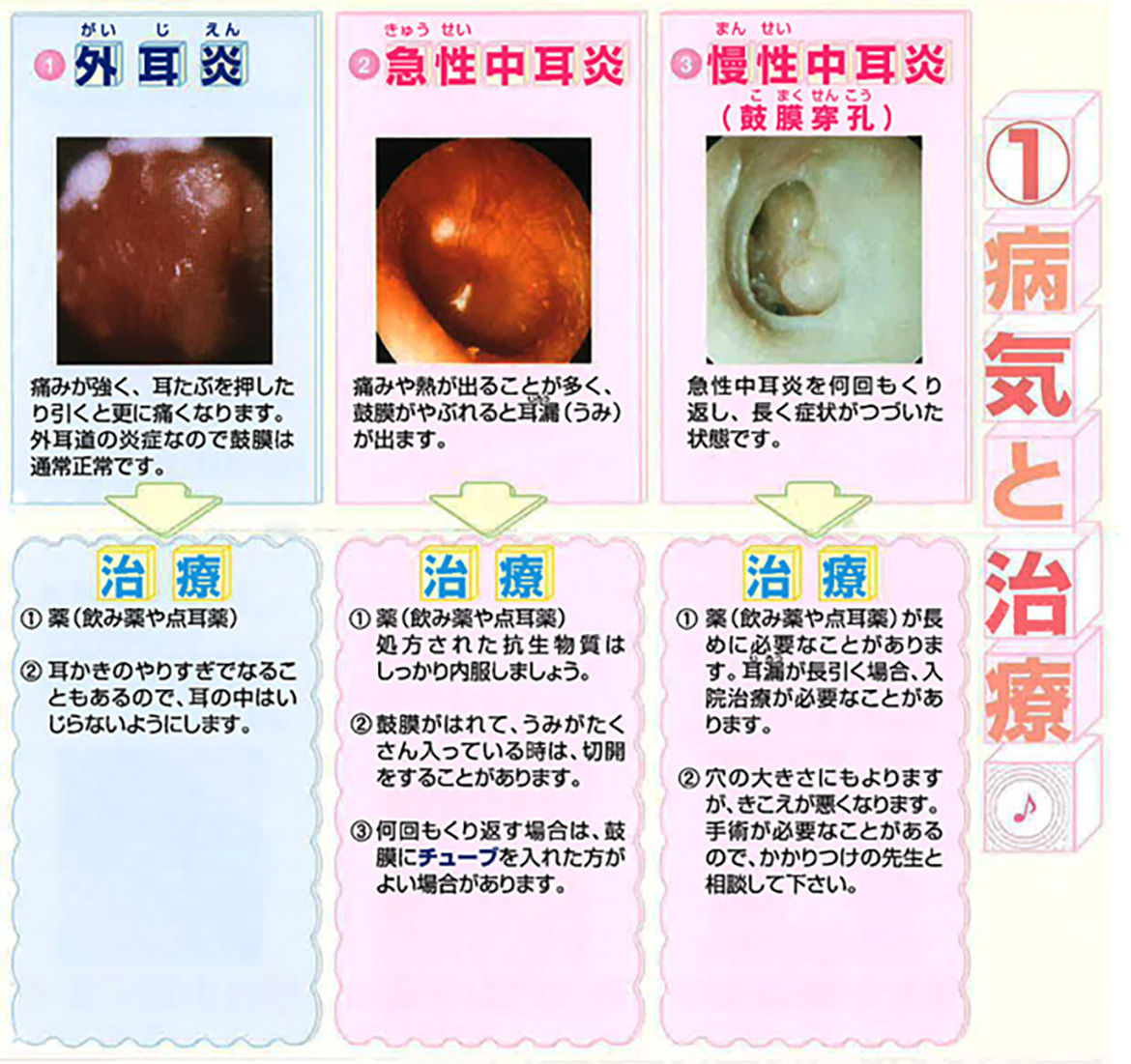 病気と治療　外耳炎　中耳炎