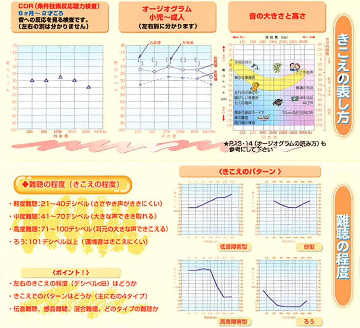 難聴の程度