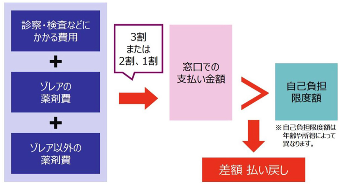 ゾレアを使用した場合の医療費